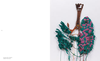 A close-up of a mixed-media sculpture of human lungs and a trachea made from colorful coiled wires. The brown trachea and bronchi connect to a spiky, teal left lung and a teal right lung decorated with pink rosettes. The piece is adorned with small circuit boards and trailing wires, including strands of barbed wire, blending organic and technological elements against a plain white background.