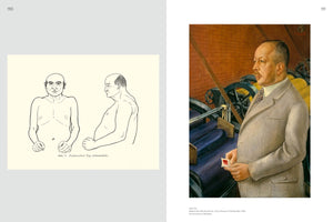 A two-page book spread comparing a scientific illustration to a realistic painting. On the left, a line drawing shows a shirtless, stocky man from the front and side, labeled Pyknischer Typ. On the right is Otto Dix's painting of Dr. Julius Hesse, a man with a similar physique, wearing a suit and standing in a factory with large machinery.