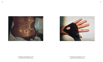 A diptych of two color photographs against a white background. On the left, a close-up of a person's bare torso has German words and diagrams projected onto the skin in white light. On the right, a hand rests on a surface, partially covered by a dark shadow with a bright, oval-shaped cutout of light on its back.
