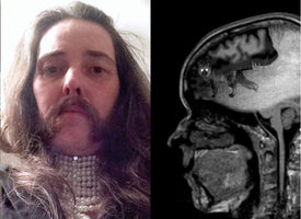 A two-panel image comparing a person with long hair and a mustache to a black-and-white MRI scan of a human head. A small fox with glowing eyes has been digitally added inside the brain portion of the MRI scan.