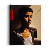 The cover of the WORLD PRESS PHOTO 2025 book, showing a portrait of a young boy with amputated arms wearing a white tank top. He is dramatically lit from the side by warm light, casting one half of his face and body in deep shadow. He has a solemn expression and is looking away from the camera.